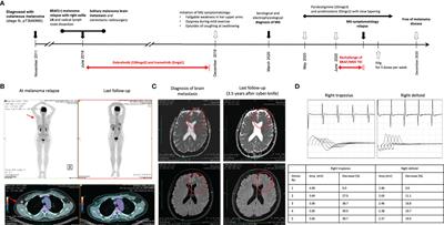 Neuromuscular Complications of Targeted Anticancer Agents: Can Tyrosine Kinase Inhibitors Induce Myasthenia Gravis? Getting Answers From a Case Report up to a Systematic Review